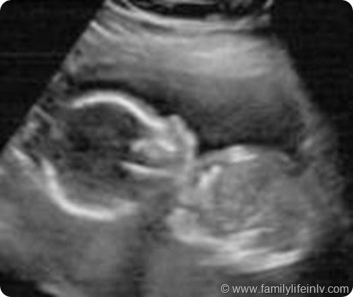 First Ultrasound