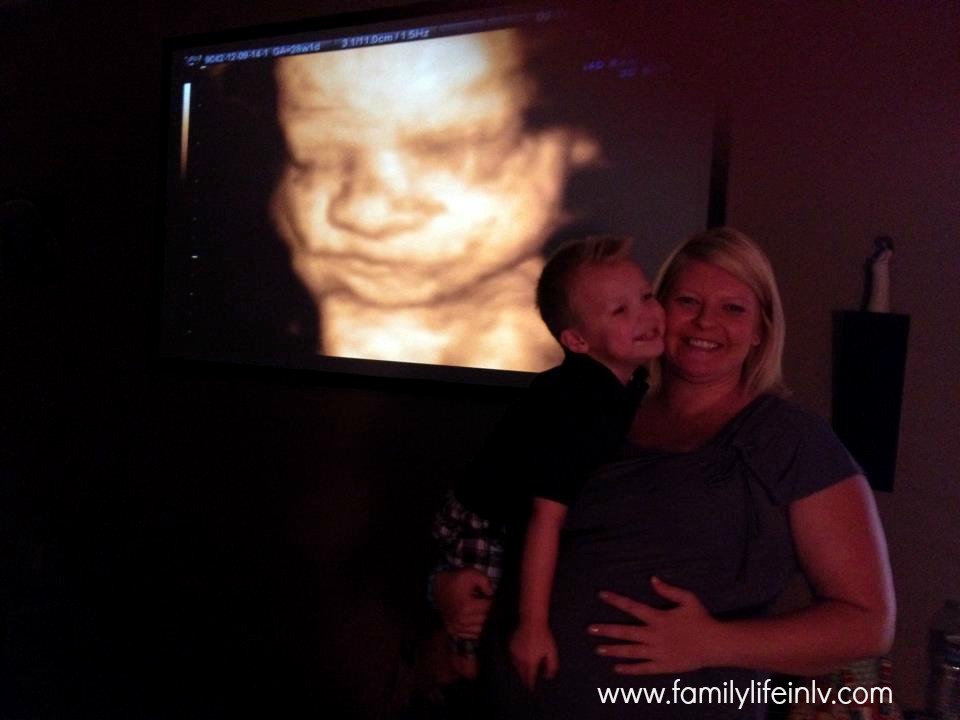 "3d/4d Ultrasound Images" "3D Ultrasound" "Pregnancy" "Baby Bump" "Las Vegas"
