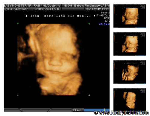"3d/4d Ultrasound Images" "3D Ultrasound" "Pregnancy" "Baby Bump" "Las Vegas"