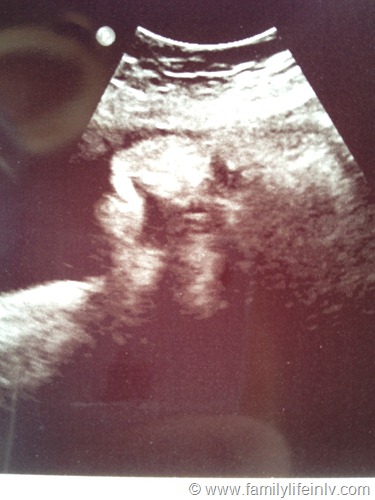 "Baby Ultrasound" "36 week Ultrasound" "36 weeks pregnant" "Baby at 36 weeks"