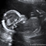 20 Week Baby Bump Pregnancy Update!